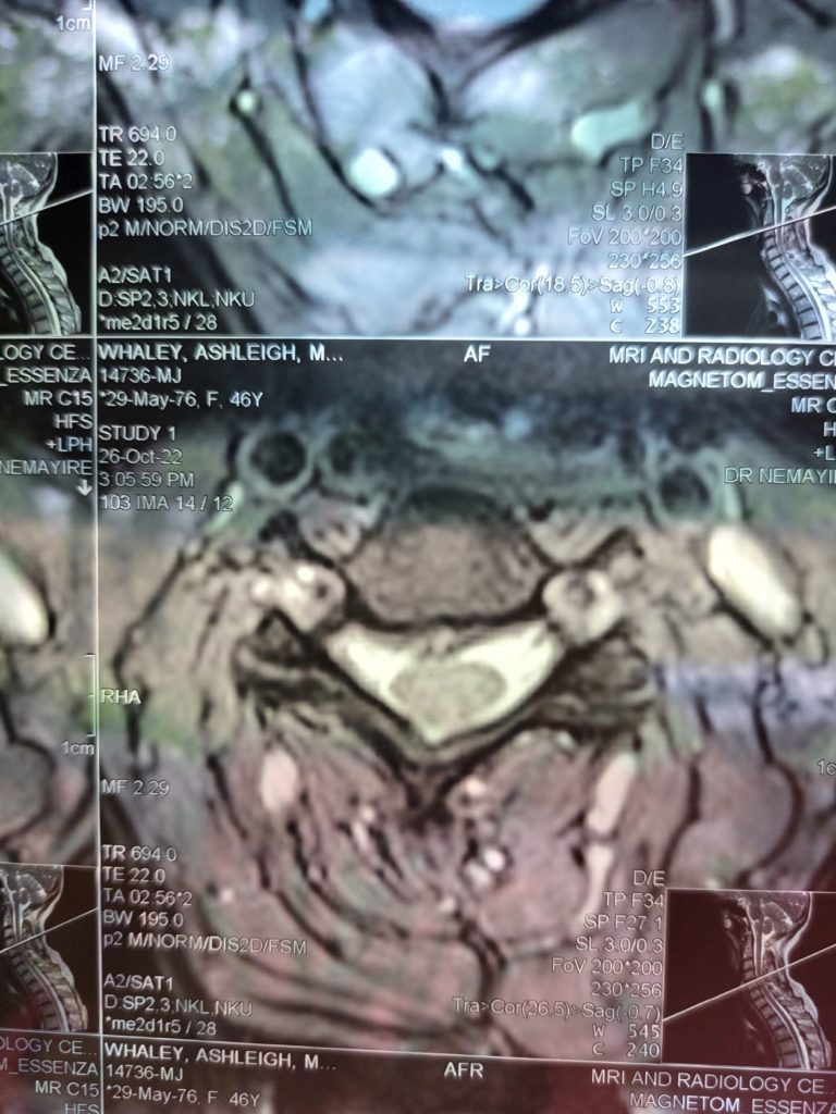 mri schan