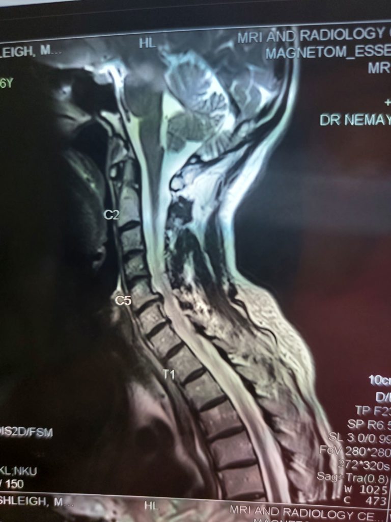 mri scan neck